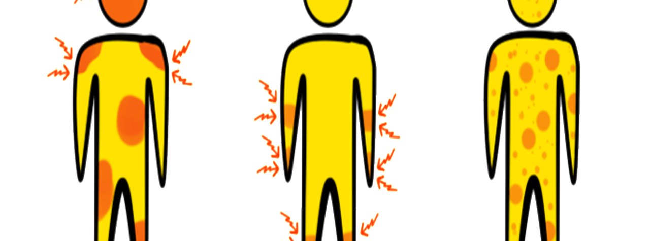 HOW DO YOU GET DENGUE FEVER